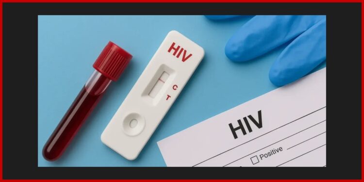 Budjenje svesti: Nažalost HIV otkrivaju tek kada je kasno