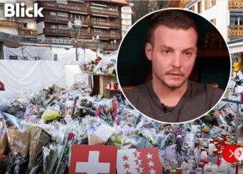 Potresna ispovest žrtve koja se probudila iz kome nakon požara u Švajcarskoj