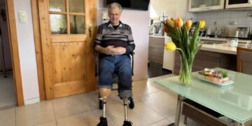 Posle odmora u Hrvatskoj ostao bez obe noge: Teška infekcija promenila život Austrijanca